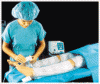 静脈血栓塞栓症を予防するための電子警告