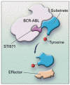 慢性骨髄性白血病の急性転化における BCR-ABL チロシンキナーゼ阻害剤