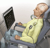 「閉じ込め状態」の患者における埋込み型脳コンピュータインターフェース