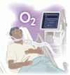 ICU における酸素療法を管理する