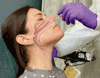 鼻咽頭スワブで粘膜検体を採取する