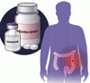 進行性転移性大腸癌に対する併用療法